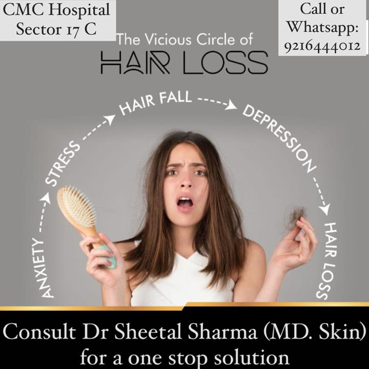 Hair Loss Consultation